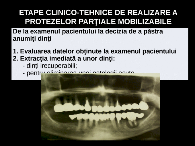 Etapele Clinico Tehnice De Realizare A Protezei Totale Curs 10+11 - etape clinico-tehnice proteze scheletate
